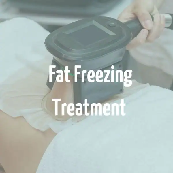 fat freezing treatment uk