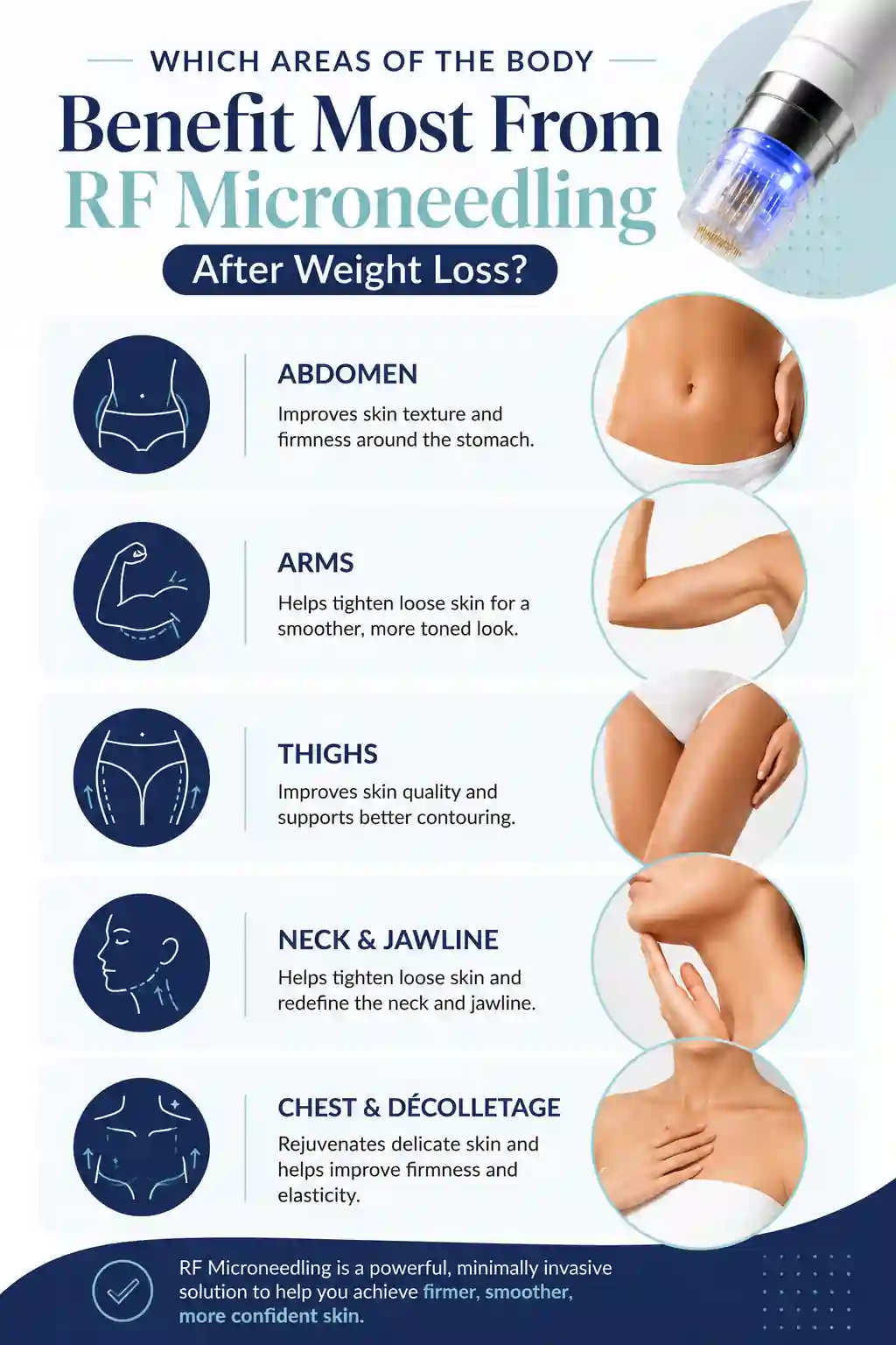 Which Areas of the Body Benefit Most From RF Microneedling After Weight Loss uk